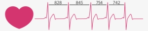 Heart Rate Variability Graph - Heart Rate Variability Analysis