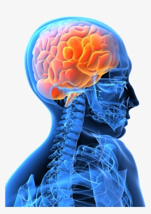 Stroke Treatment And Management Of Its Effects With