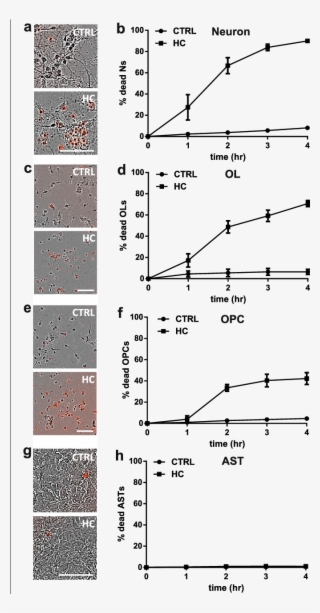 Human Complement Is Toxic To Mouse Neurons And Oligodendrocytes