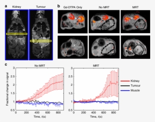 Mrt Of Magnetic Cells Into Tumours Does Not Affect