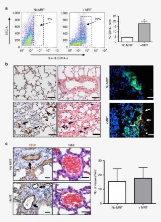 Magnetic Macrophages Were Steered Into Pulmonary Metastasis