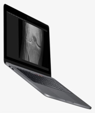 Image Biopsy Lab Software Laptop - Output Device