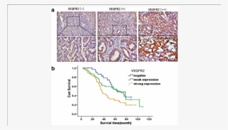 Expressions Of Vegfr2 In Colon Cancer Samles And Kaplan - Map
