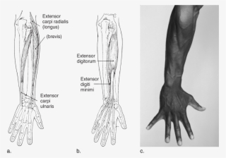 Image Not Available - Medical Radiography