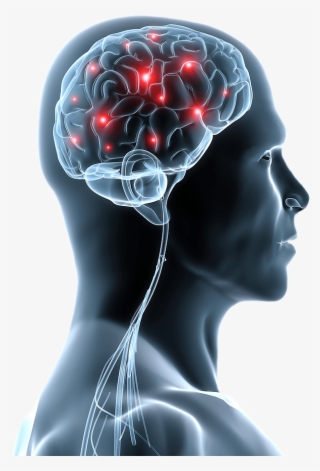 Change The Brain - Headaches Anatomy