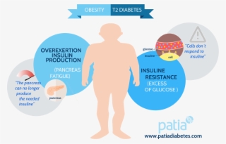 Obesity Type 2 Diabetes - Diabetes Type 2
