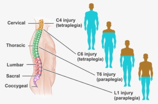 What Is Spinal Cord Injury - C7 Spinal Cord Injury