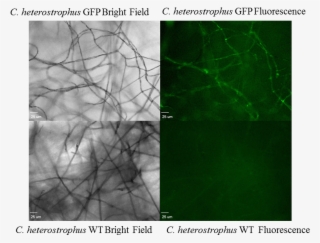 Fluorescence Microscopy Showed Evidence Of Gfp Expression - Photo Caption