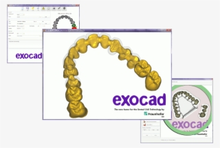 52, 29 August 2010 - Exocad