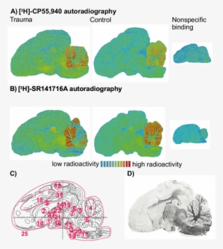 Autoradiographs Of Adjacent Slices Of The Piglet Brain - Diagram