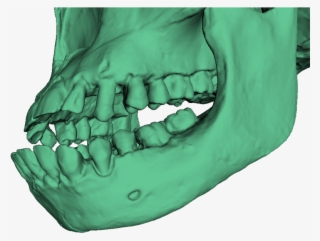 A 3d Model Of Turkana Boy's Skull Without Texture - Smile