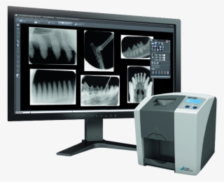 Im3 Cr7 Vet Dental Xray System - Cr7 Dental X Ray
