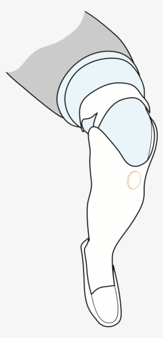A Technical Drawing Of Cindy's Lower Leg, With A Circle - Sketch