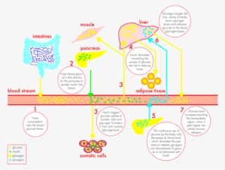 By Hyperglycemia As A Result Of Improper Insulin Secretion - Cartoon