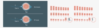 Chromosome Conditions Chromosome Conditions - Diagram