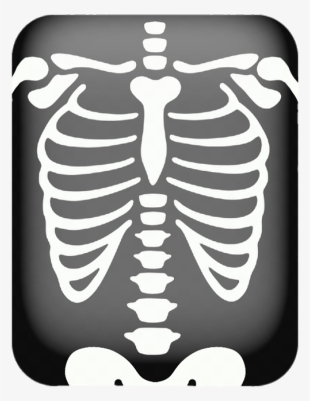 X Ray Png - Chest X Ray Cartoon