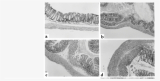 Photomicrographs Of The Proximal Colon Of Mice Treated - Monochrome