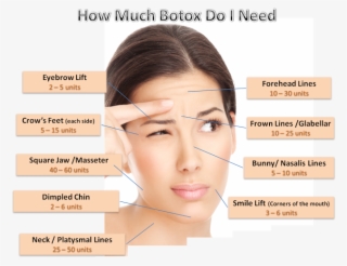 How Much Botox Will I Need - Can I Get Botox