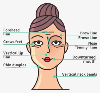 Botox Injection Sites Forehead, Brow, Forwn, Crows, - Cartoon