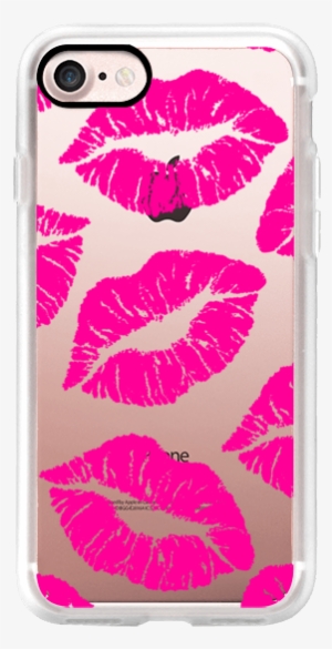 Casetify Iphone 7 Classic Grip Case - Pucker Up Throw Blanket