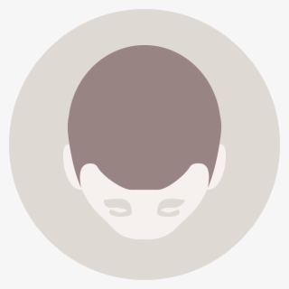 Men's Hair Loss - Circle