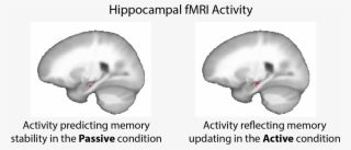 Our Results Showed That Activity In The Hippocampus - Rib