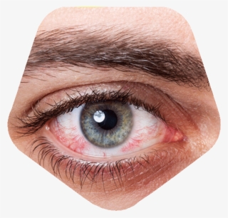 Dry Eyes - Daño A Los Ojos Por El Celular