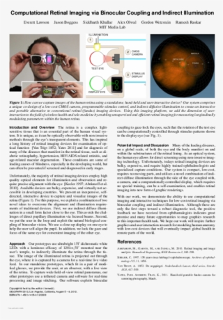 computational retinal imaging via binocular coupling - discovery of achilles on skyros
