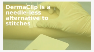 Dermaclip Is A Needle-less Alternative To Stitches - Comfort