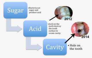 Cavities - Diagram