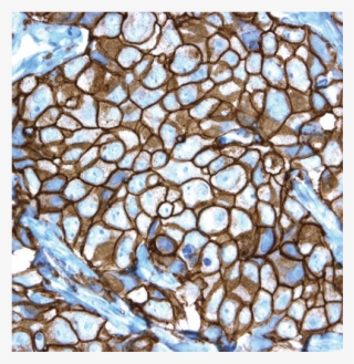 Pathway® Her-2/neu Rabbit Monoclonal Primary Antibody - Stained Glass