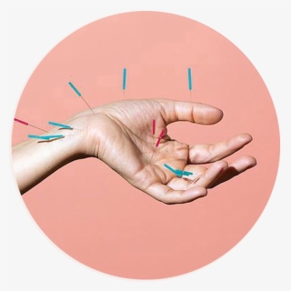 Acupunture - Akupunktur Can Acıtır Mı