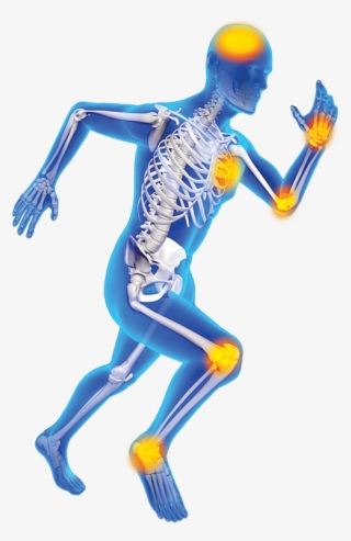Joint Pain Skeleton - Skeleton Pain