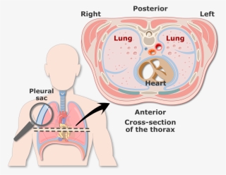 2591 X 1851 2 - Pleurae And Pleural Cavities