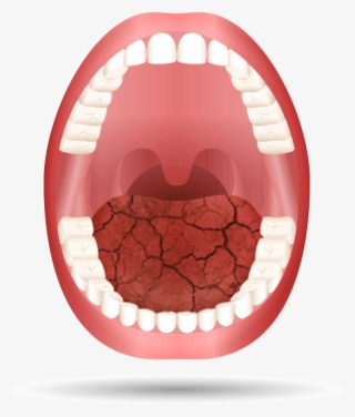 Medication Open Mouth Animation - Name Of Teeths In Human Mouth