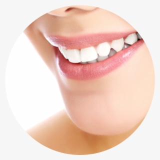 Crowns Are Called Indirect Restorations, Because The - White Teeth With Face Png