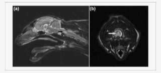 Sagittal T2-weighted (t2w) Image Of The Head And Neck - Radiology