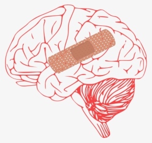 Brain Injury Clip Art At Clker - Stroke Clipart